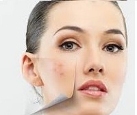 Угревая сыпь на лице: причины, лечение, уход, диета, маски