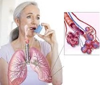 Бронхиальная астма - причины, признаки, формы, симптомы, профилактика и лечение у взрослых